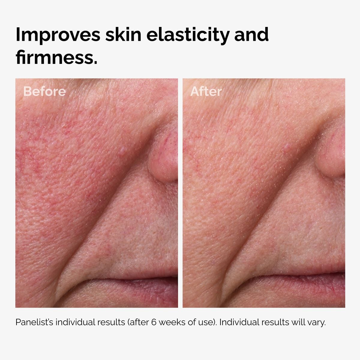 100-fermented-rose-hip-seed-oil-l2 100pct-fermented-rose-hip-before-after-elasticity.jpg