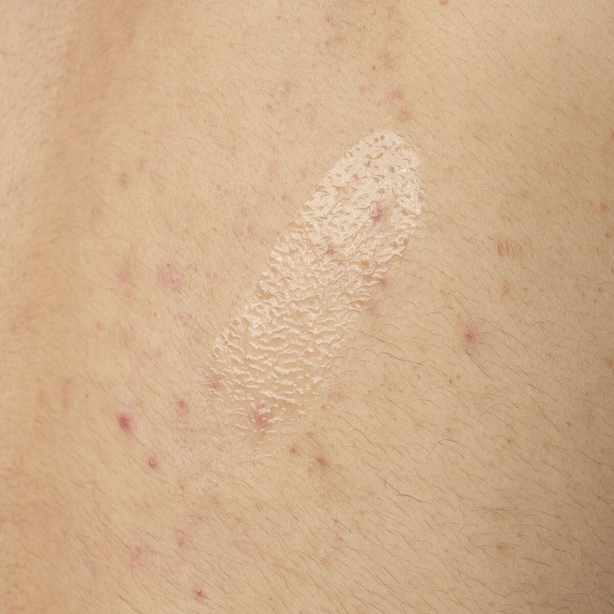 salicylic-acid-0-5-body-serum-y0 ORD-salicylic-acid-05-body-240ml-application.jpg