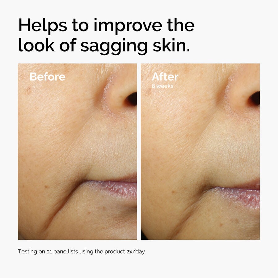 caffeine-3-escin-1-face-serum-h2 ord-caffeine-3pct-escin-1pct-face-serum-before-after-sagging.jpg