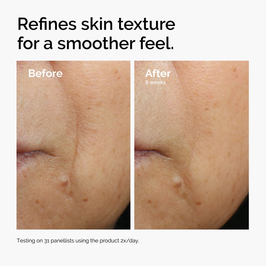 caffeine-3-escin-1-face-serum-h2 ord-caffeine-3pct-escin-1pct-face-serum-before-after-texture.jpg