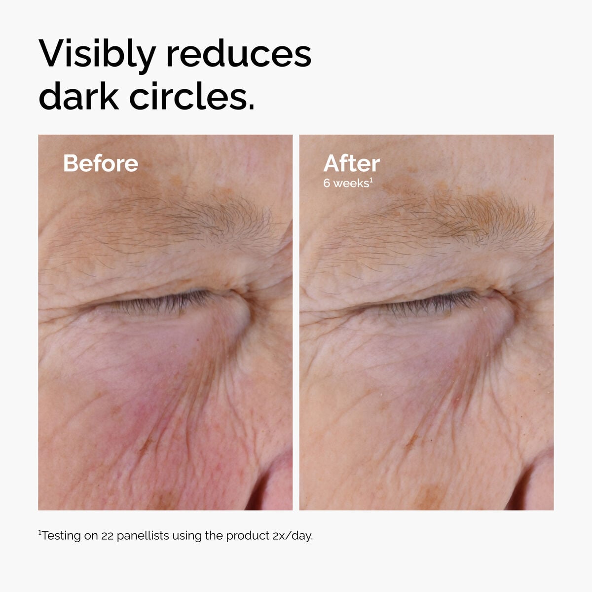 caffeine-solution-5-egcg-eye-serum-n0 ord-caffeine-solution-egcg-dark-circles-before-after.jpg