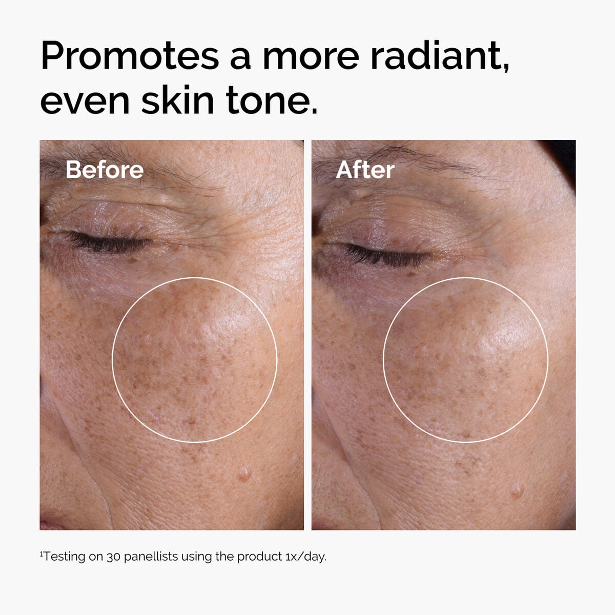 glycolic-acid-7-exfoliating-toner-a8 ord-glycolic-before-after-radiance.jpg