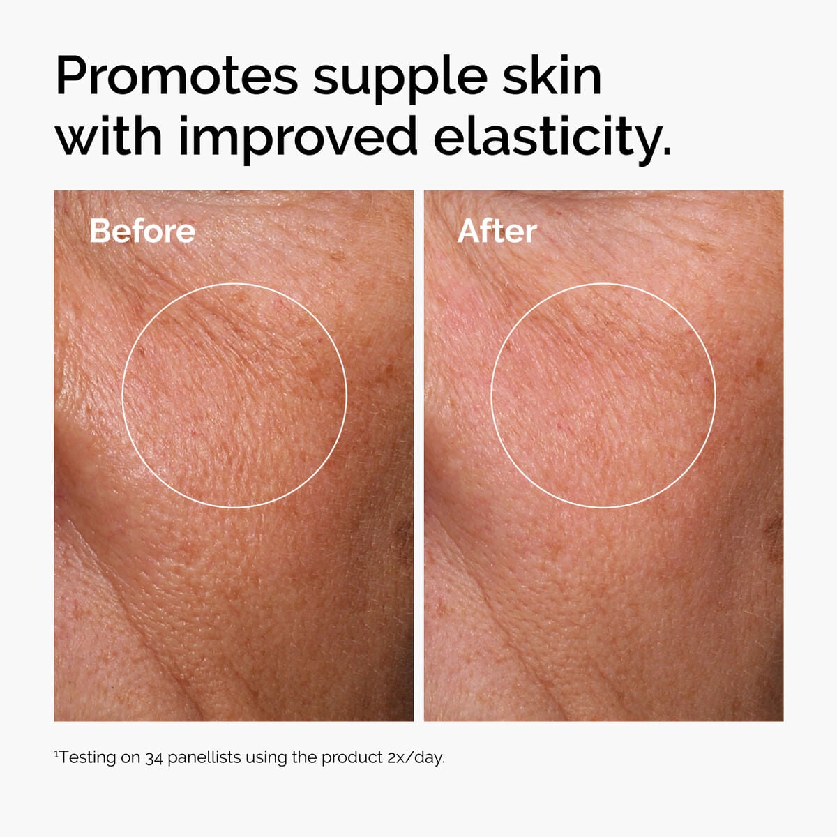hyaluronic-acid-2-b5-with-ceramides-o9 ord-hyaluronic-acid-2pct-b5-hydrating-serum-before-after-elasticity.jpg