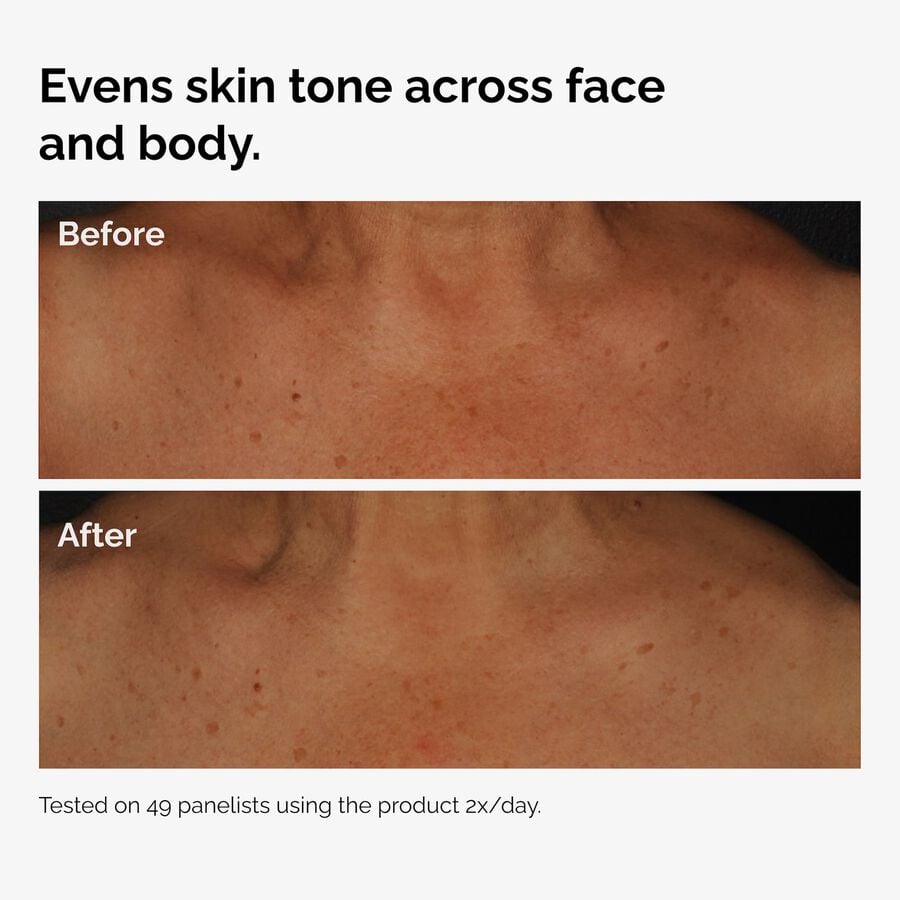 the-body-care-collection-n8 ord-niacinamide-face-body-serum-before-after-even-tone-graphic.jpg