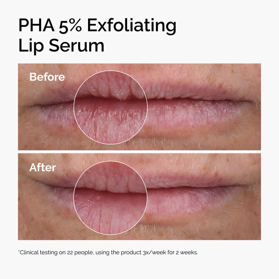 pha-5-exfoliating-lip-serum-l4 ord-pha-5pct-lip-exfoliating-serum-before-after.jpg