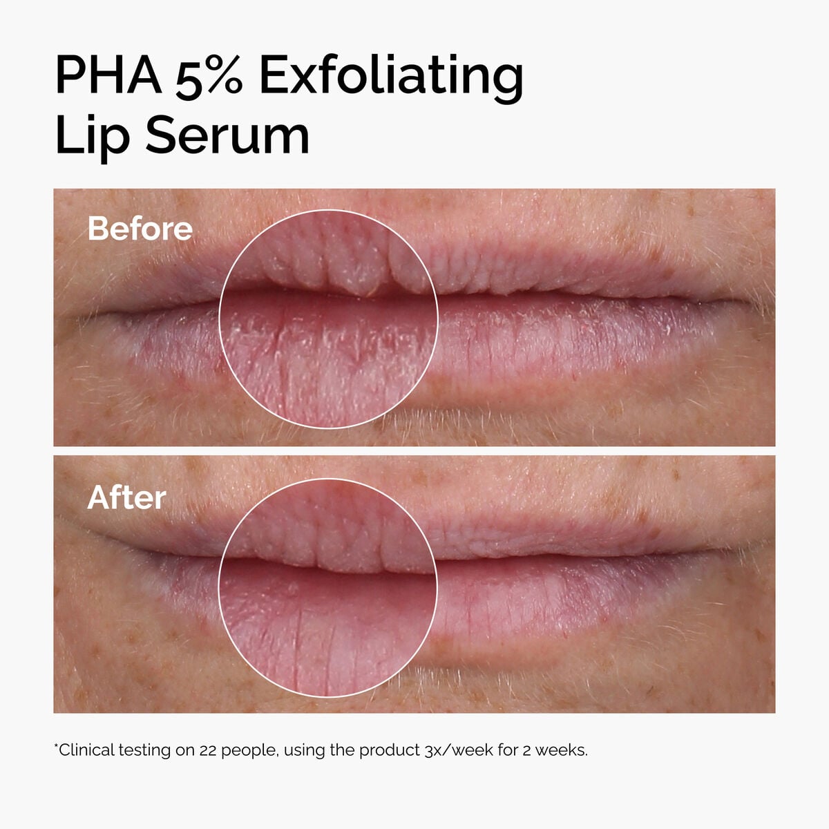 pha-5-exfoliating-lip-serum-l4 ord-pha-5pct-lip-exfoliating-serum-before-after.jpg